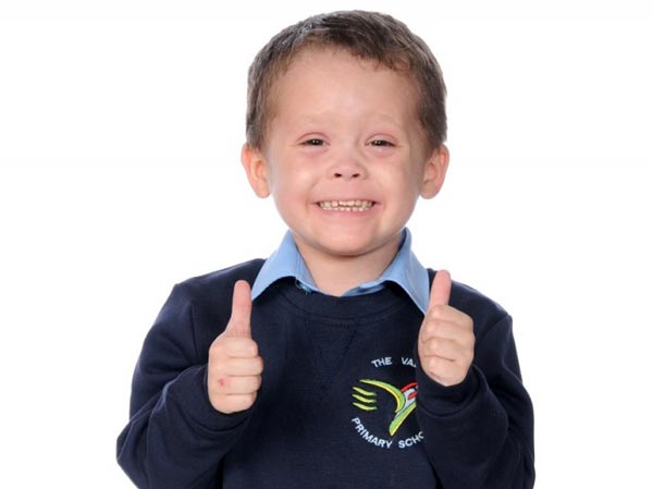 British boy with eczema wins support from Chinese Internet users