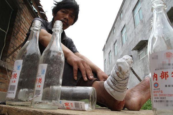 Man loses five toes from overdrinking