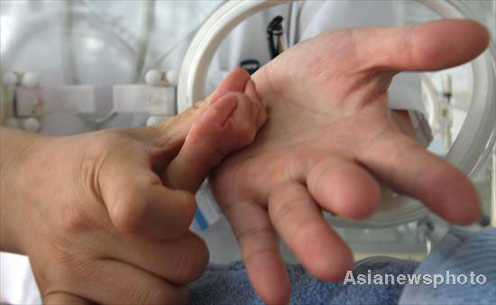 Quadruplets born in E China