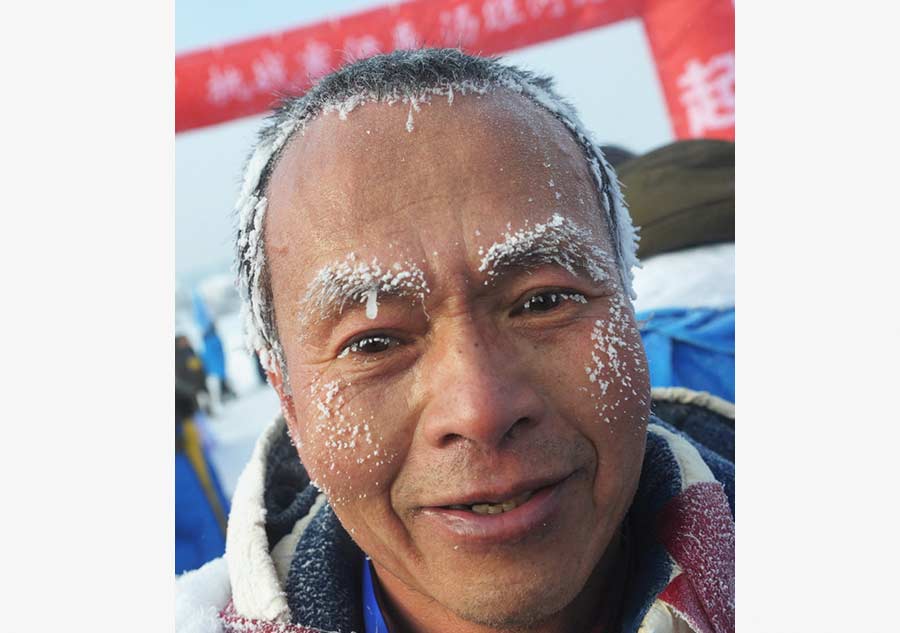 Hair, eyelashes turn white as temperature falls to minus 30 in Heilongjiang