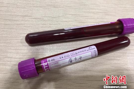 Woman caught with 203 blood samples set for gender tests