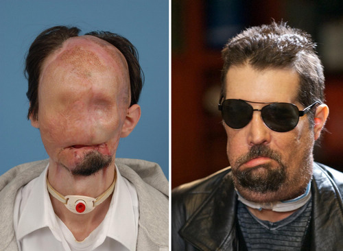 First US face transplant patient makes debut
