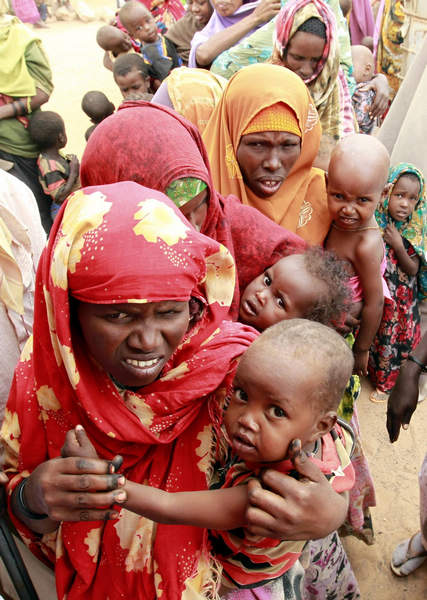 Displaced Somalis suffer from malnutrition