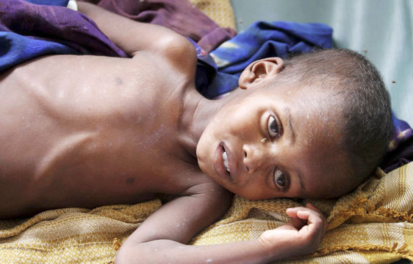 UN set to declare famine in parts of Somalia