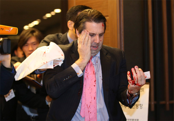 US ambassador to South Korea slashed in face by assailant