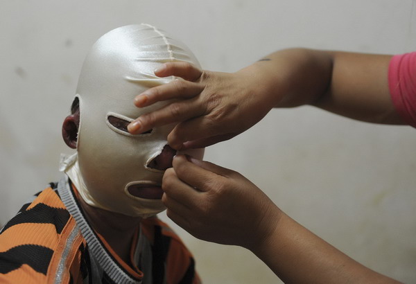 Mask to help heal boy