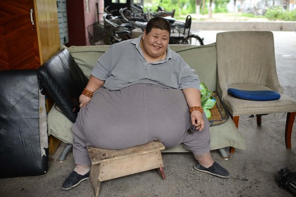 250 kg man, 33, saved from heart failure