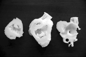 Chinese surgeon uses 3D printing to map out difficult heart surgery