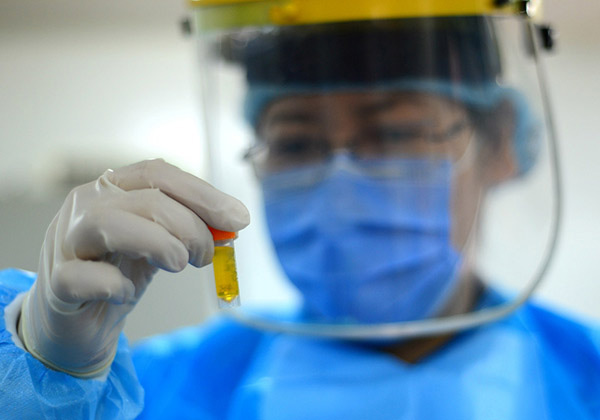 Chinese scientists claim possible breakthrough in HIV, hepatitis cure