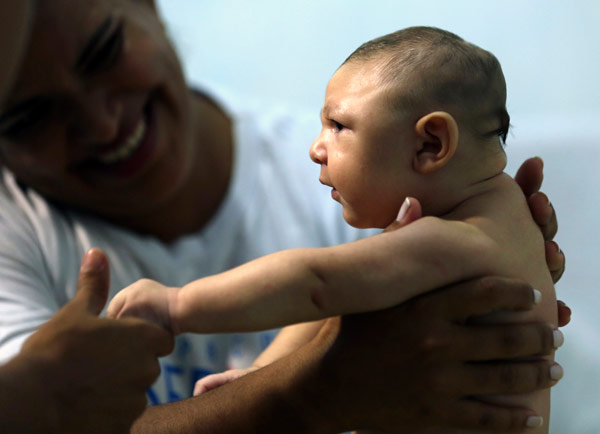 Confirmation that Zika causes microcephaly shifts debate to prevention